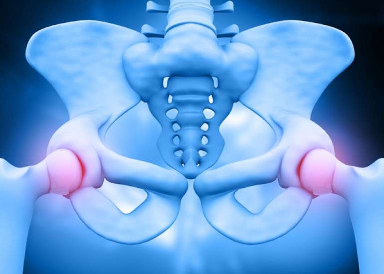 ओस्टाइटिस प्यूबिस क्या है? कारण, लक्षण और इलाज | Osteitis Pubis in Hindi