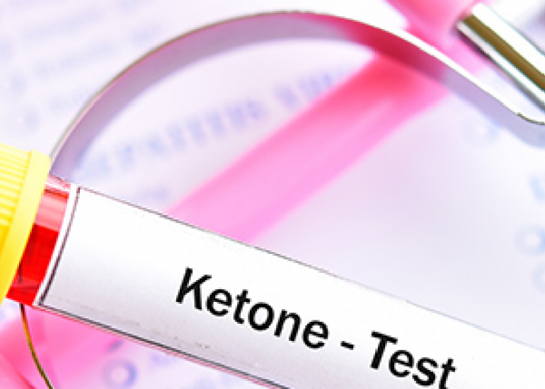 Factors Predicting Diabetic Ketoacidosis at Commencement of Type 1 Diabetes among Pediatric Patients