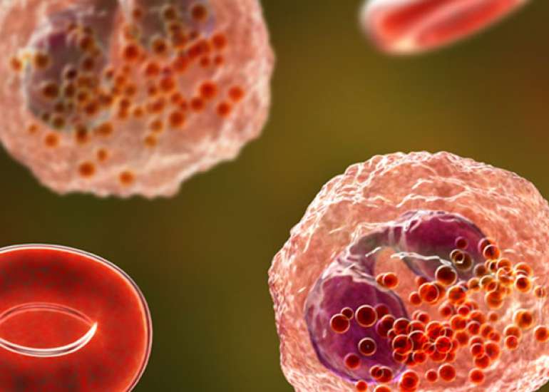 Pediatric eosinophilic esophagitis: a review for the clinician