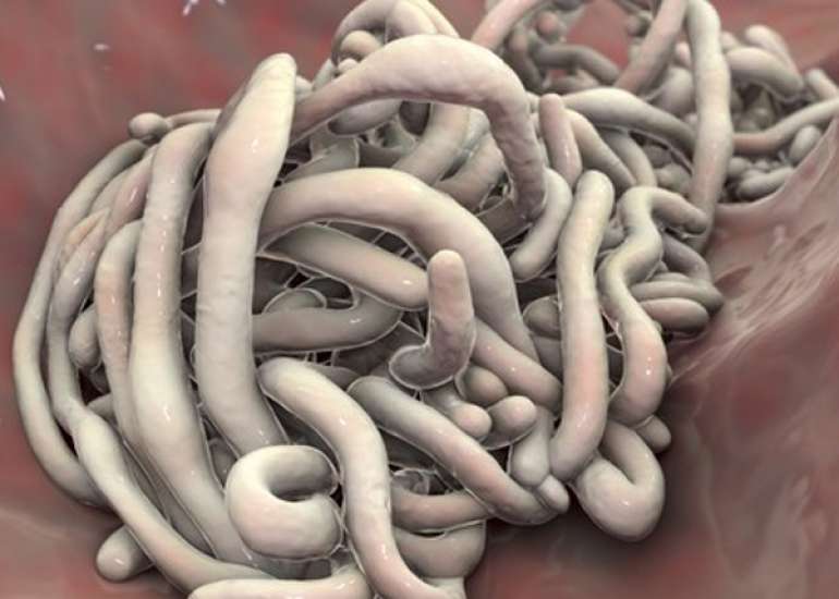 पिनवॉर्म क्या है? कारण, लक्षण और इलाज | Pinworm in Hindi