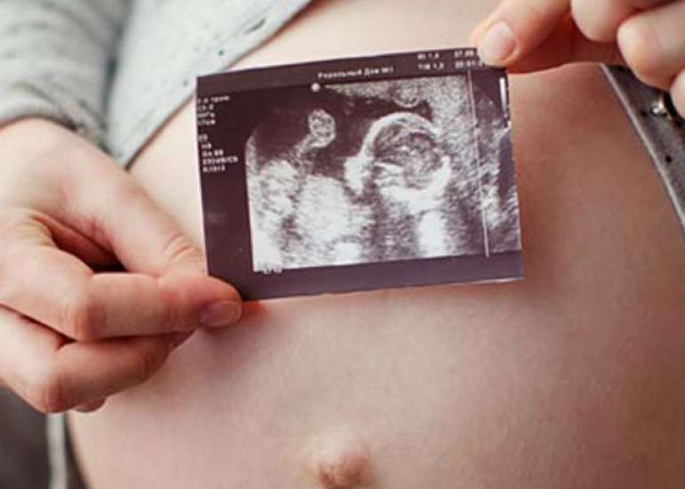 Preservation of female fertility: The current therapeutic strategy