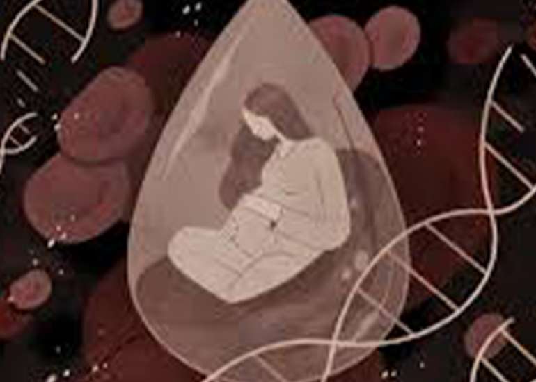 Pseudohyponatremia in pregnancy