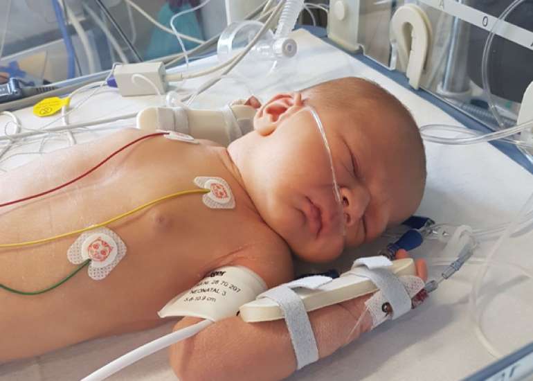 Pulmonary Atresia in Children and its Preventive Measures