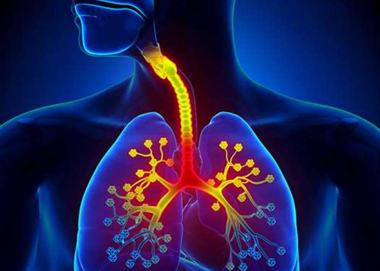 Raising Pollution is Increasing Respiratory Issues: Things to Do