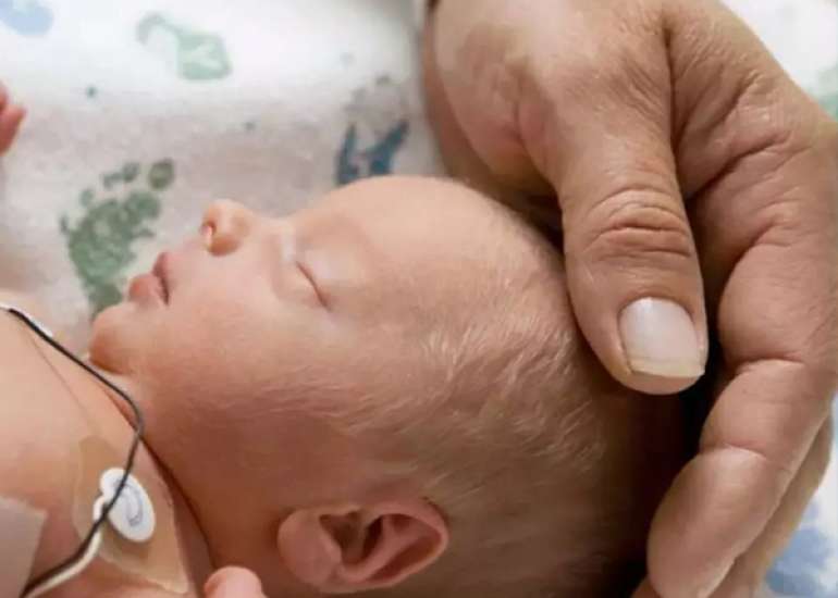 Recurrence of preterm births