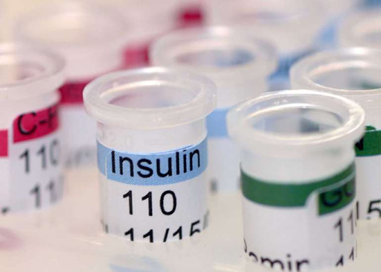 Right time to initiate Insulin Therapy