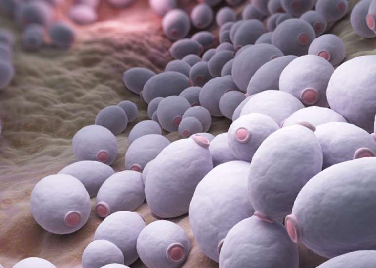 Risk factors for vulvovaginal candidiasis in various age groups