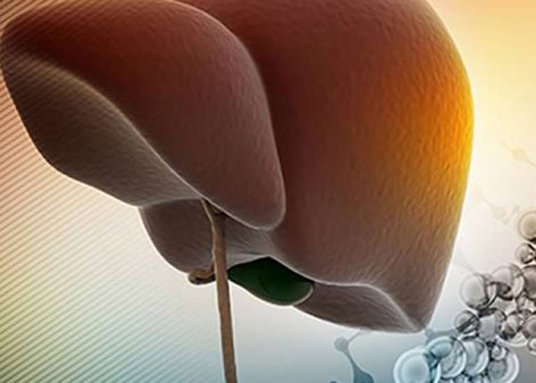 Role of Combination Therapy in Alcoholic Fatty Liver Disease