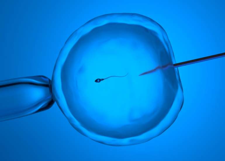 Role of Intracytoplasmic sperm injection in IVF treatments in patients with advanced maternal age or low oocyte number.