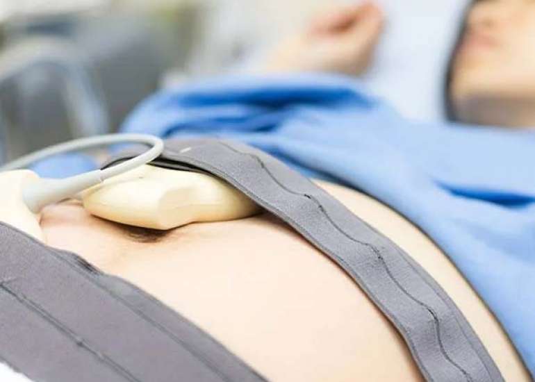 Role of Modified ISTH DIC Score in Cases of Abruptio Placentae