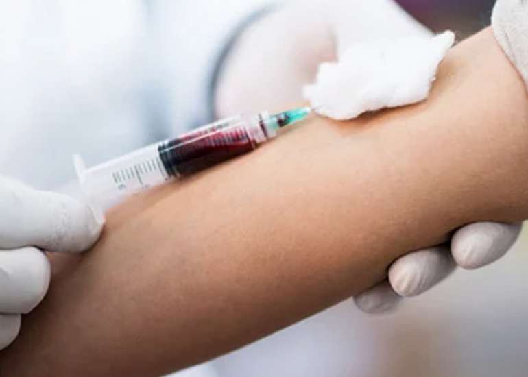 Serum Calcium Blood Tests and Their Clinical Relevance