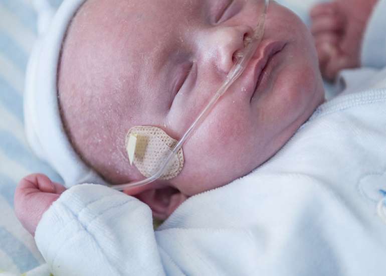 Severe PAH in Healthy Infants