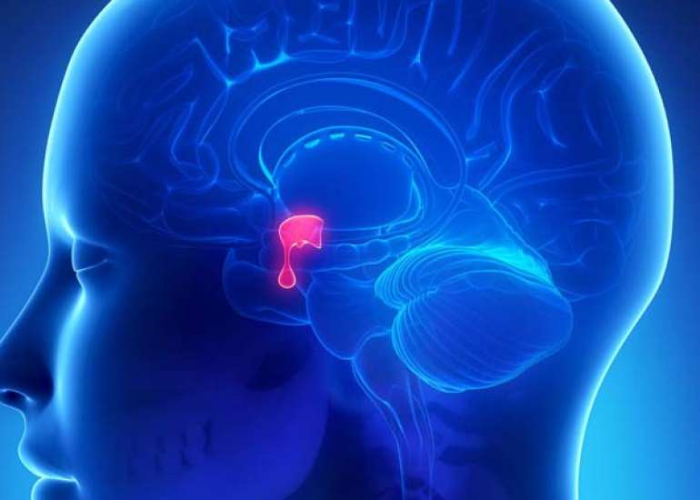 Sheehan’s Syndrome – characterized by severe postpartum bleeding, shock, and hyponatremia