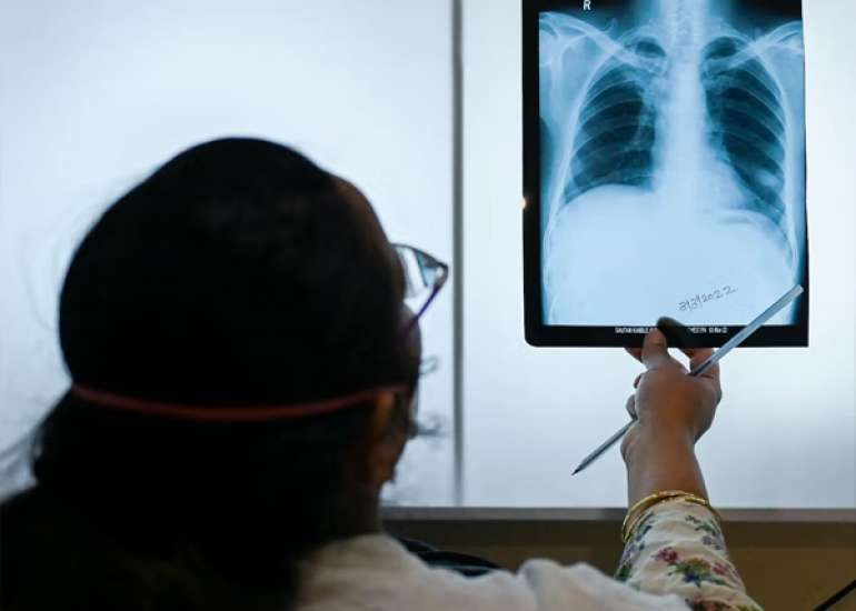 Shorter Treatment for Nonsevere Tuberculosis in African and Indian Children