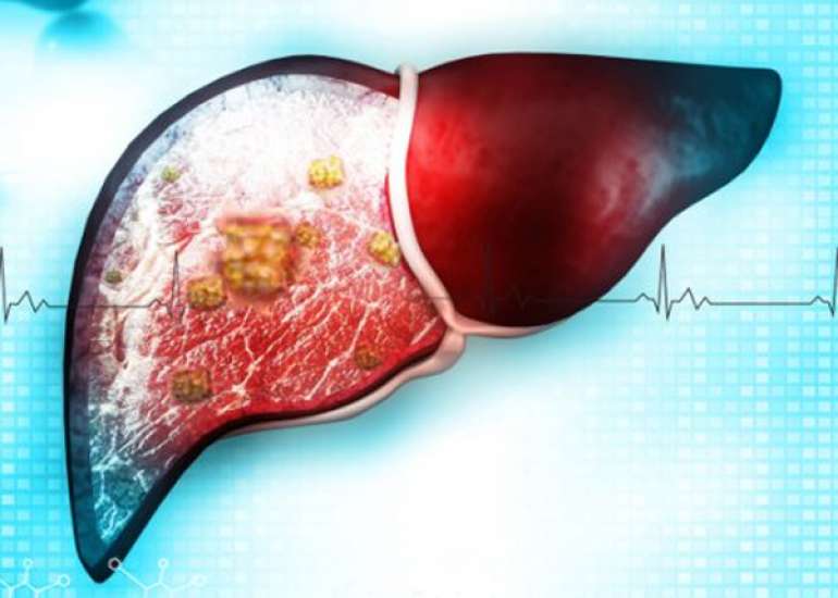 Liver Diseases in Special Populations (Children, Elderly, and Pregnancy)
