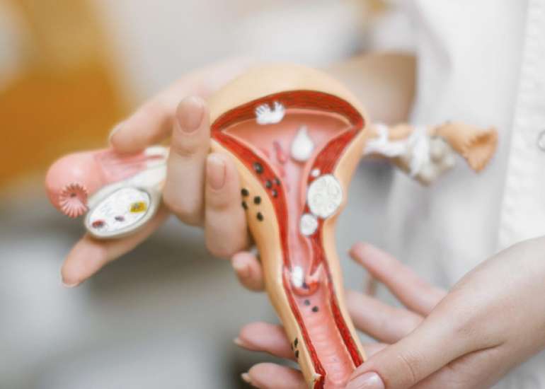 Spontaneous rupture of a bicornuate uterus