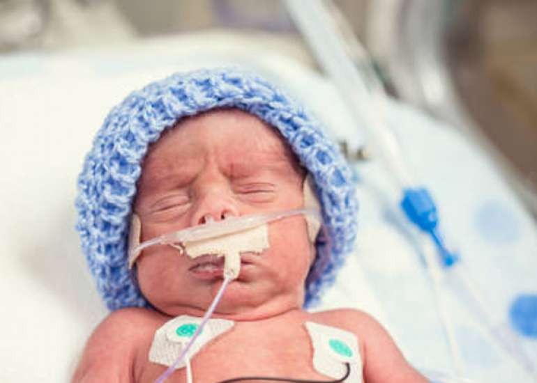 Supplemental Oxygen in the Newborn: Historical Perspective and Current Trends