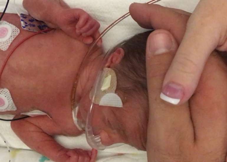 Surgical intervention in a case with VSD?