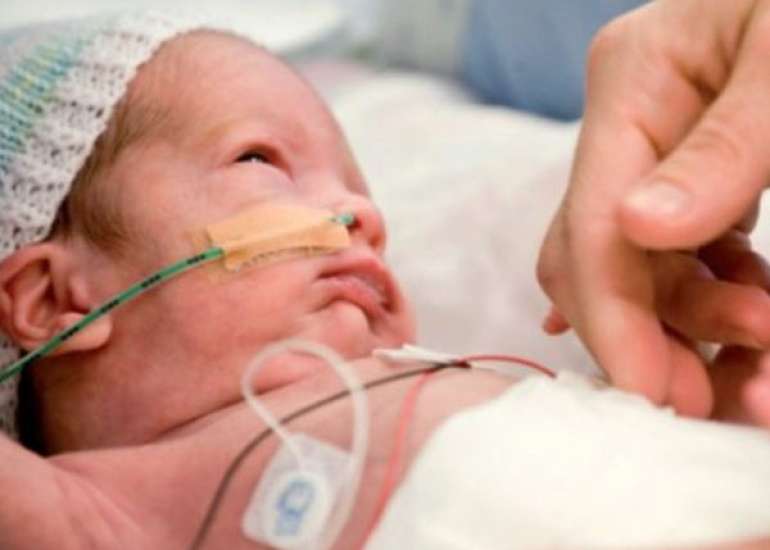 The Autism Detection in Early Childhood Tool: Level 2 autism spectrum disorder screening in a NICU Follow-up program