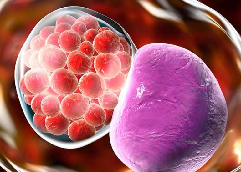 The Correlation between Chlamydia Trachomatis and Female Infertility: A Systematic Review