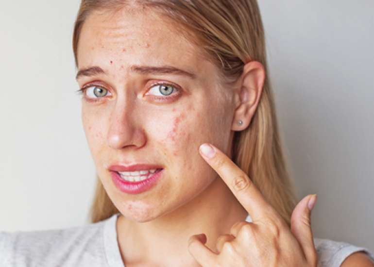 Treatment of allergy in homeopathy is individualistic or it can be like group treatment that is....?