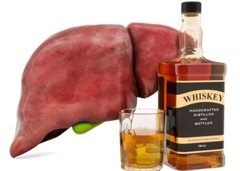 Treatment of Alcoholic Liver Injury