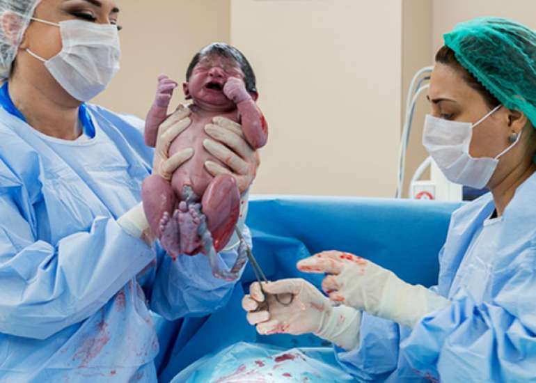 Trial of labour after caesarean delivery