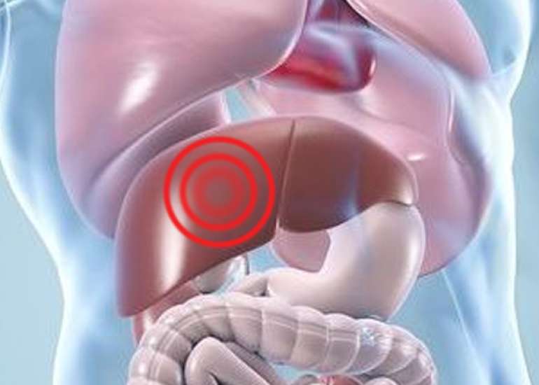 Understanding Liver Diseases In Women