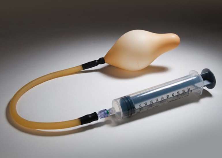 Uterine balloon tamponade for managing postpartum hemorrhage