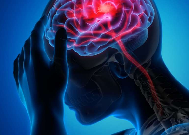 Validation of a Clinical Tool to Predict Neurological Outcomes in Critically Ill Children