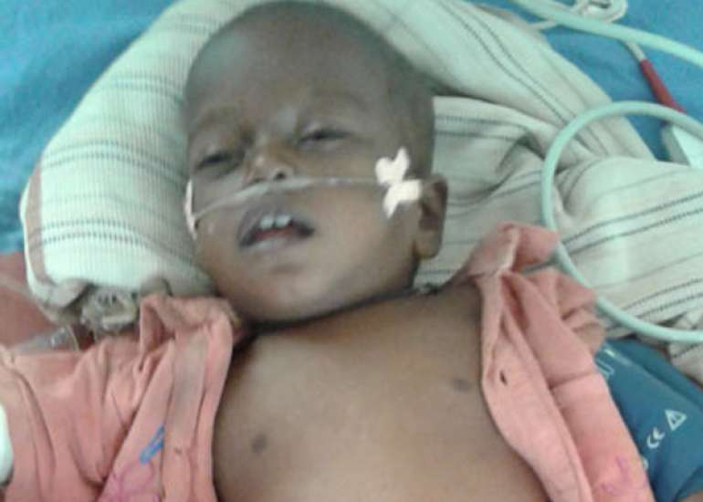 Vitamin B12 Monotherapy Versus Combination Multi-Nutrient Therapy for Infantile Tremor Syndrome