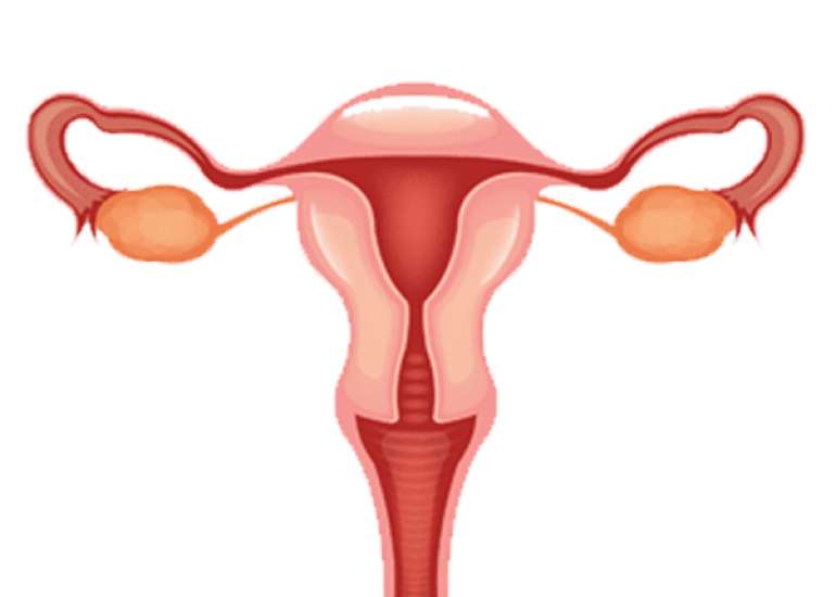 Vitamin D Deficiency and Metabolic Syndrome In patients with Polycystic Ovarian Disorder (PCOD) Along With Anti-Mullerian Hormone Levels