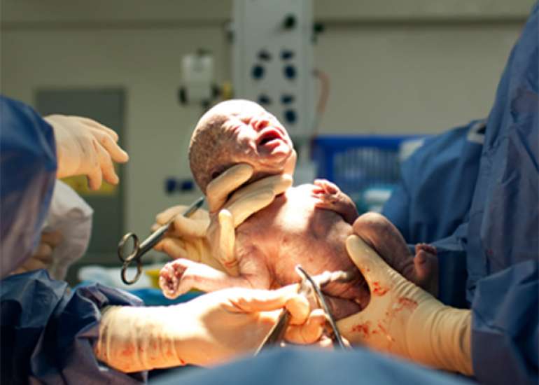 Weight-Based versus Fixed-Dose Enoxaparin Prophylaxis - Cesarean Delivery