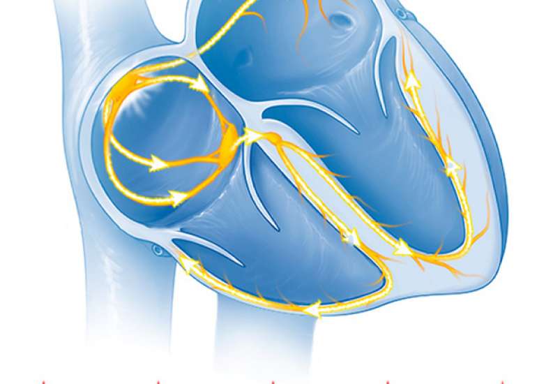 What are the Non- pharmacological methods for supraventricular arrhythmias?