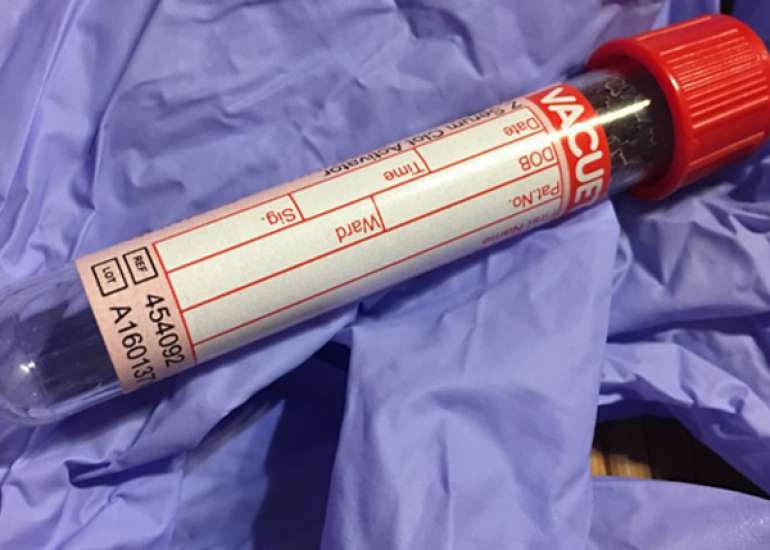 What are the blood tests for infertility?