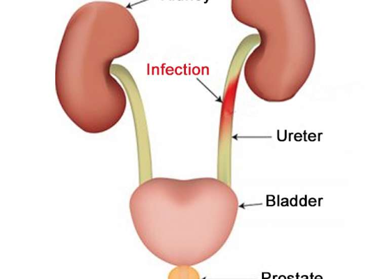 What can cause recurrent urinary infections?