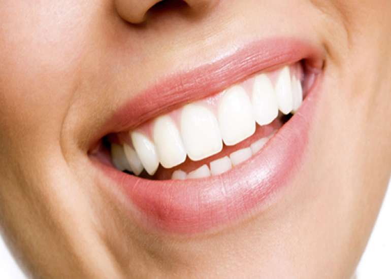 What everybody should know about dental fluorosis?