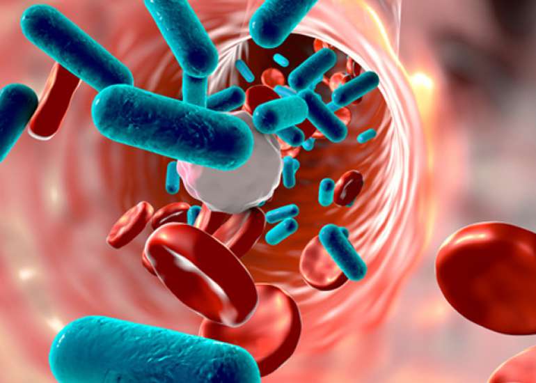 What is a sepsis team & sepsis code?