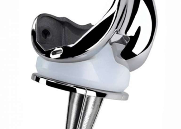 What is complete knee cobalt-chromium implant?