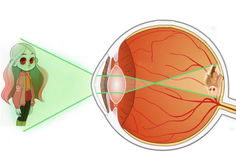 What is retinopathy of prematurity (ROP)?