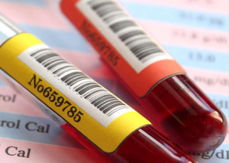 What is the HDL test?