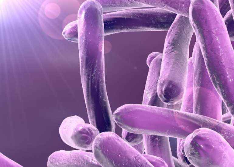 What is the diagnosis of Mycobacterium tuberculosis?