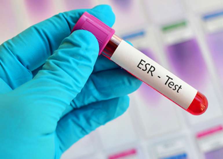 What will happen if ESR is increased?