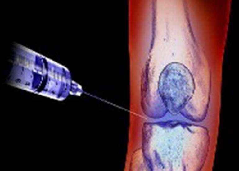 What is the role of steroids in osteoarthritis knee?