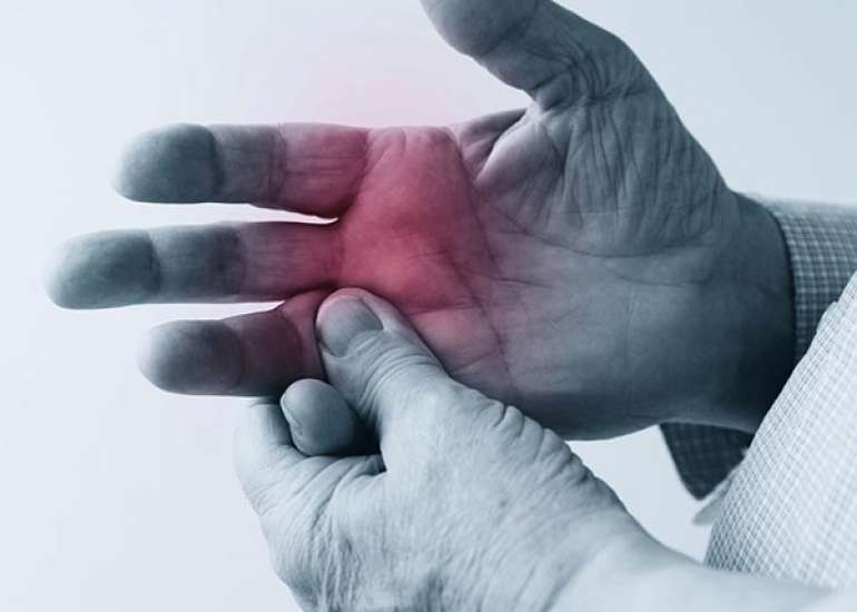 What is Rheumatoid Arthritis?