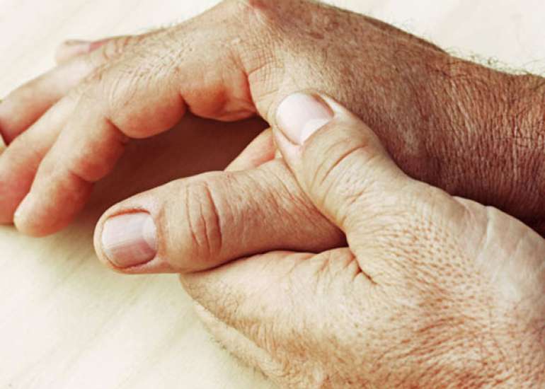 What are collagen vascular diseases?