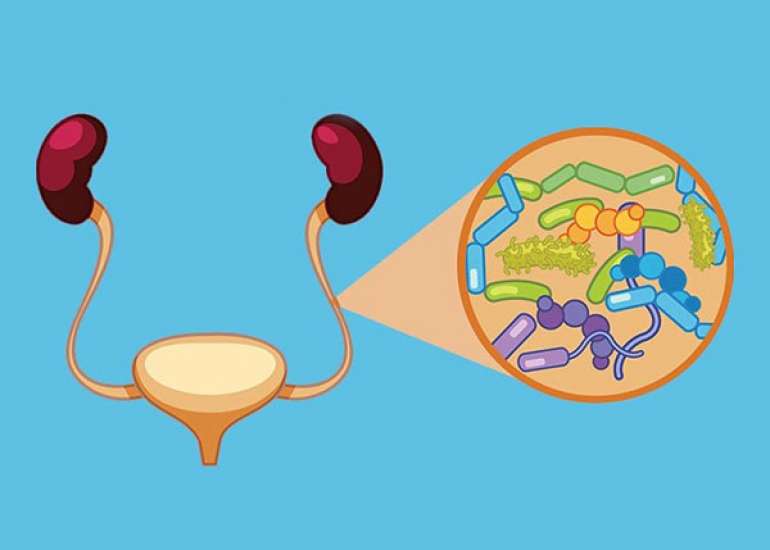What are the Main Causes of UTI?