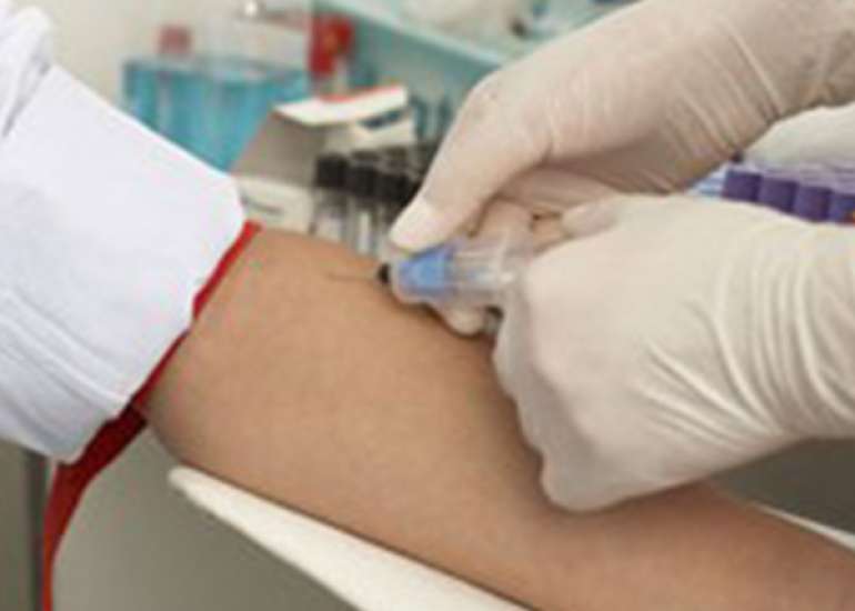 What do we mean by fasting blood glucose test?