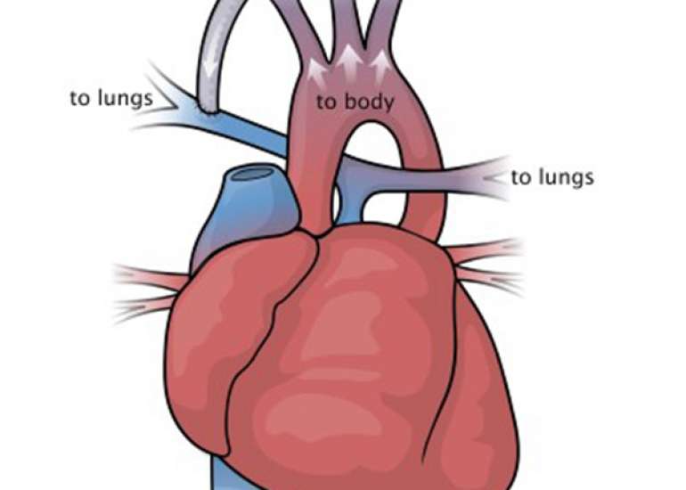 What is a single ventricle?