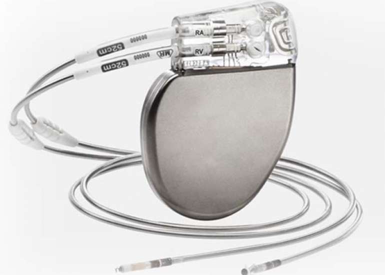 What is the life of a pacemaker?